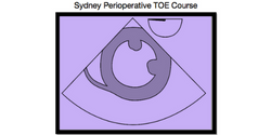 Sydney TOE Course Co-operative